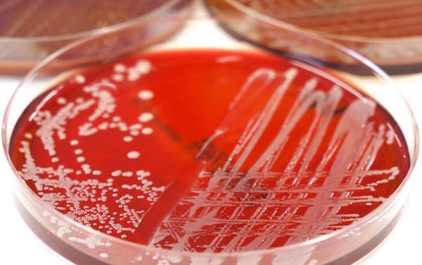 Wisconsin bacteria outbreak known as Elizabethkingia spreads as CDC alerts hospitals